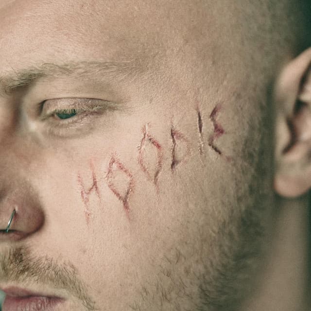 CO ROZK*RWIA GŁOWĘ